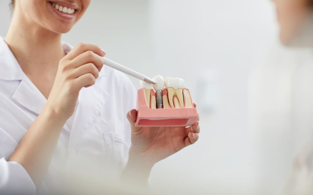 implantes dentales sin hueso
