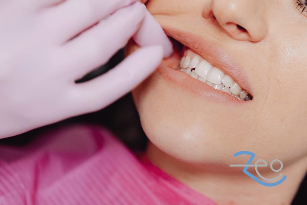 Blanqueamiento dental en Las Rozas