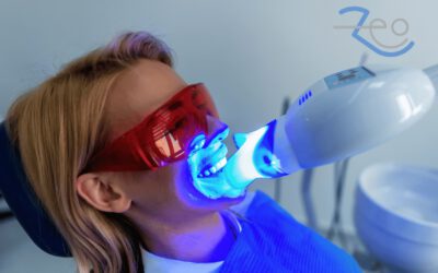 Blanqueamiento dental en Las Rozas: qué hace realmente el peróxido en tu esmalte