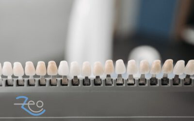 Carillas dentales: qué son y por qué no implican tallar tu diente