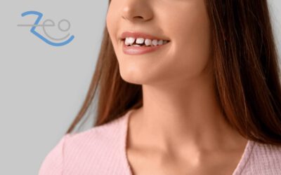 Diastema: por qué se separan los dientes y cómo cerrar el hueco