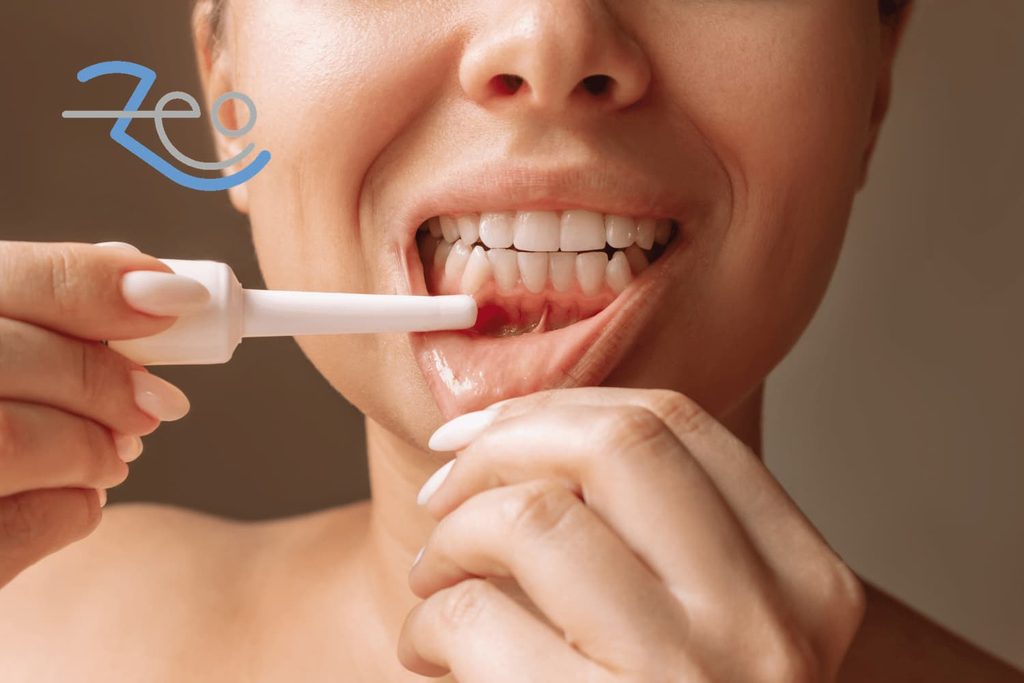 Enfermedad periodontal en Las Rozas, Madrid